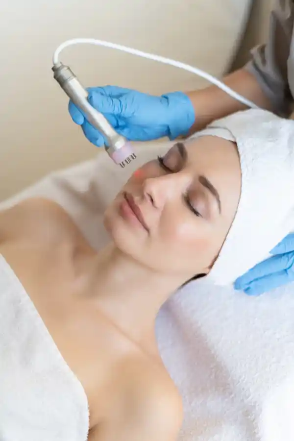 RF-Radiofrequency-Aesthectic-Treatments Bournemouth