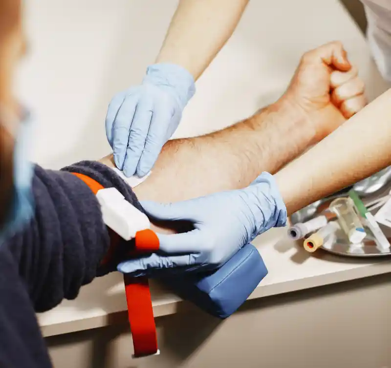 PRP-TREATMENT-BOURNEMOUTH
