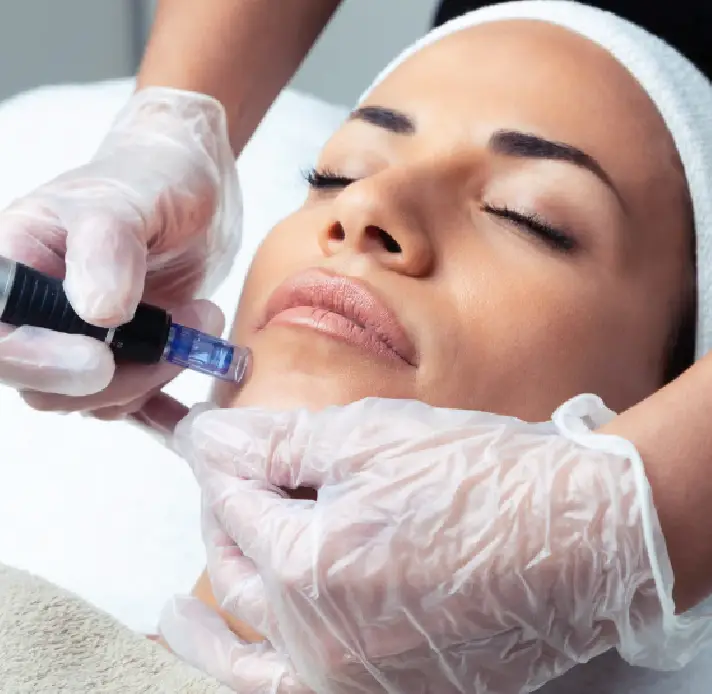 best prices for Microneedling in bournemouth 